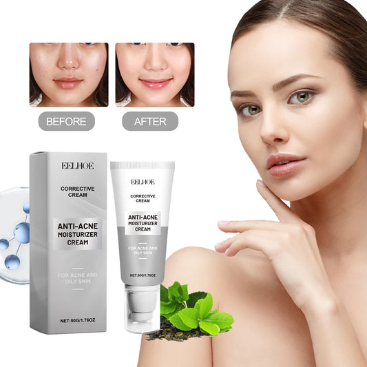 Whitening Anti Acne Cream Skin Care